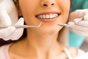 Surgical Orthodontics in Little Elm &#038; Prosper, TX